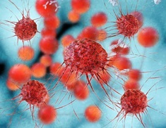 Microscopic view of cancer cells