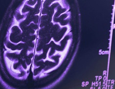 Scan of a brain on a dark screen